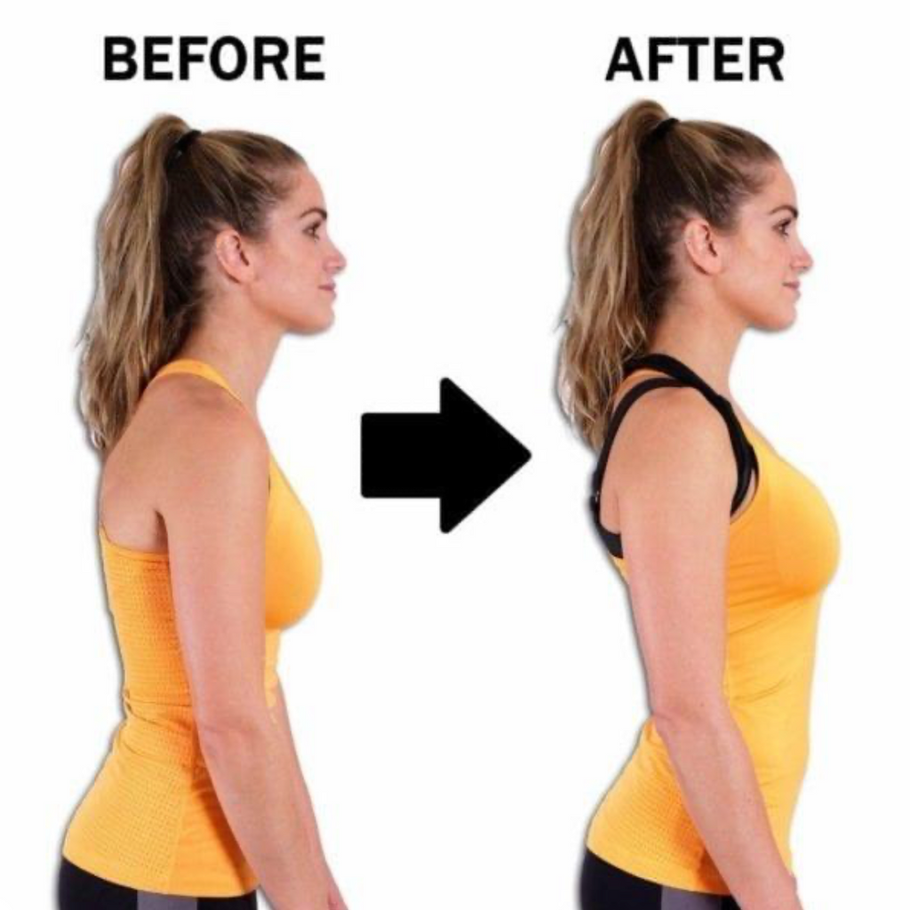 Adjustable Upper Back Posture Corrector – Shoulder & Clavicle Support Brace for Better Posture