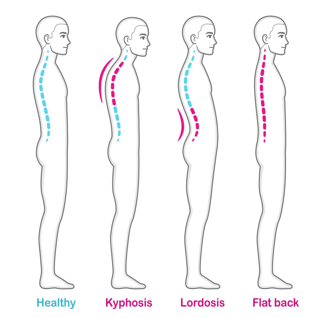 Adjustable Upper Back Posture Corrector – Shoulder & Clavicle Support Brace for Better Posture